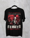 'Severe Case' Shirt-2